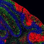 researchers-find-immun