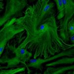 the-key-role-of-astroc