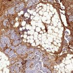 cytotoxic-drugs-can-in