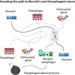 discovery-of-origin-of