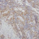 gene-implicated-in-poo