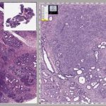 Mouse-Pancreas-With-Cancer-777x324