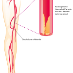 csm_2019_Periphere_Gefaessint_IT_c01cb1941c