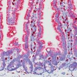 how-high-fat-diets-all