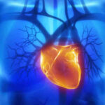 infarto miocardio_thumb_720_480