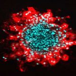 ruptures-in-cell-nucle