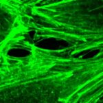 what-makes-blood-vesse