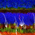 developing-treatment-f