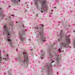 targeting-brain-iron-i