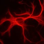 1200px-Astrocyte_-_cultutures_-_GFAP-720x406