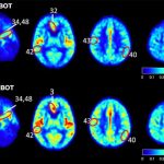 Elevated-Blood-Flow-and-Improved-Oxygenation-in-Brain-777x559