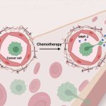 chemo-helps-breast-can