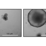 how-chronic-intestinal