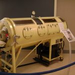 iron-lung