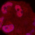 new-strategy-against-t