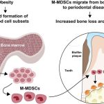 obesity-raises-the-ris