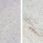 study-points-to-new-ap