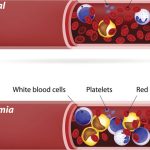 thinkstockphotos-530264507_thumb_720_480 (1)