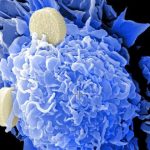 3-cancer (2)
