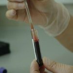 bloodsample