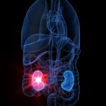 insufficienza_renale