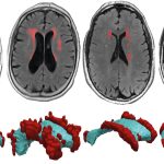 wear-and-tear-in-vulne