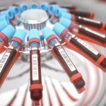 Blood-Test-Centrifuge-777x622