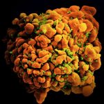 Scanning-Electron-Micrograph-of-HIV-Infected-H9-T-Cell-777x777