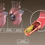 infarto1-kMAG-U3030581644397OMG-593x443@Corriere-Web-Sezioni