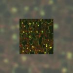 ion-channel-regulates