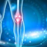 macromolecular-gel-wit