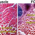 origin-of-rare-disease