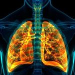 partial-bone-marrow-tr