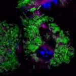 researchers-discover-w-1