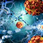 sclerosi-multipla (1)