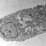 the-unexpected-benefit