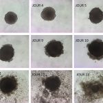 Omega-3-That-Poison-for-Tumors-777x626