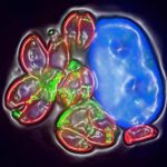 Toxoplasma-Infected-Human-Cell