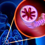 bpco-Broncopneumopatia-cronica-ostruttiva