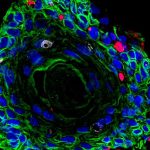 cancer-when-viruses-an