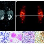 case-study-successful