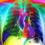 d41586-022-00403-0_20120442