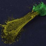drug-halts-immune-reac