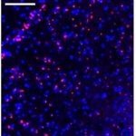 iron-accumulation-link