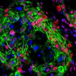 lab-results-show-promi