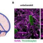 molecular-mechanism-of (1)