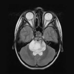 researchers-identify-n-2