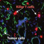 Blocking-Major-Inflammatory-Pathway-in-Pancreatic-Cancer-777x518