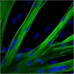 NR2_mRNA