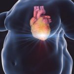 Obese-Man-Heart-Attack-Illustration-777x518